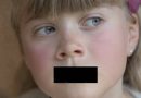 Selectief mutisme